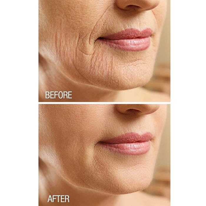 Crepe Be Gone Firming Neck Cream 3 oz.