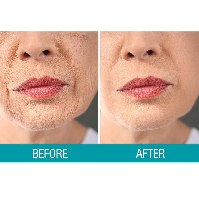 Crepe Be Gone Firming Neck Cream 3 oz.