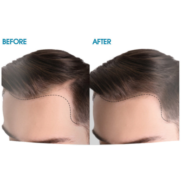 Difeel Men's Ultra Growth Basil & Castor Hair Growth Oil 8 oz.