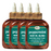 Difeel Peppermint Scalp Care Hair Oil Blend 7.1 oz. (PACK OF 4)